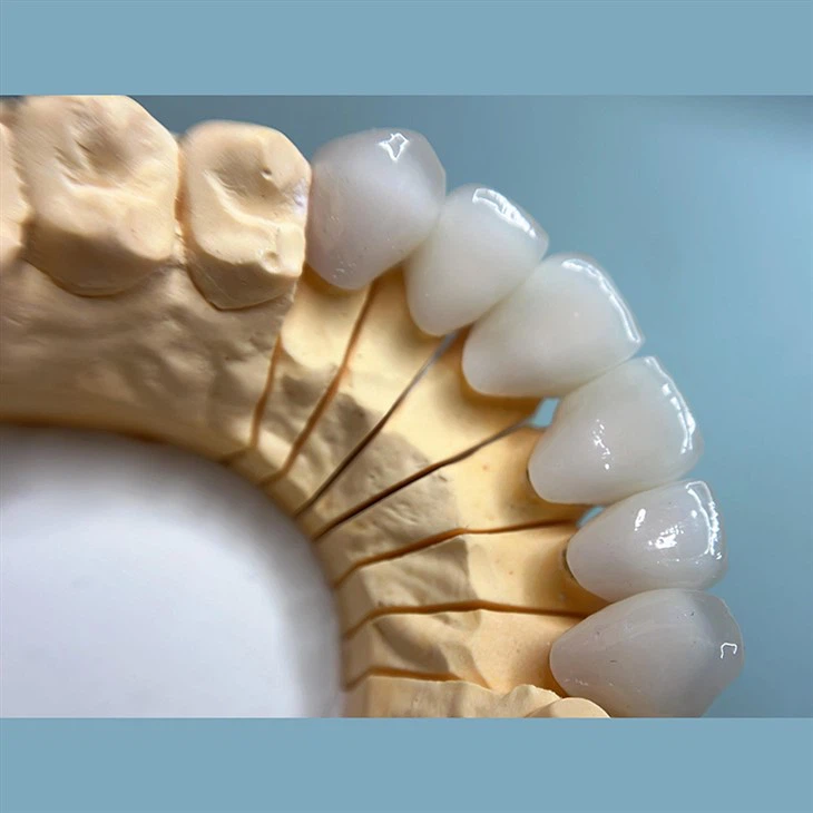 Dental Porcelain Layered Zirconia Crown factory